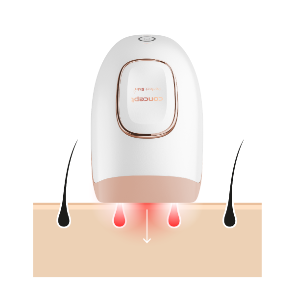 Concept Perfect Skin IL3000 IPL epilátor - Obrázek 3