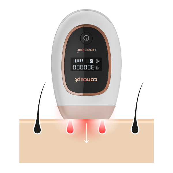 Concept Perfect Skin IL3020 IPL epilátor - Obrázek 2